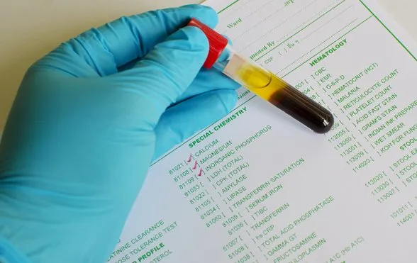 magnesium_mineral-test